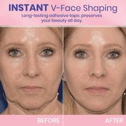 🔥LAST DAY SALE 49% OFF-🌸V-Face👑 Lifting Invisible Adhesive Tape